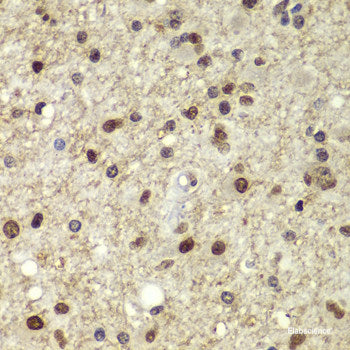 Immunohistochemistry of paraffin-embedded Human prostate using CFD Polyclonal Antibody at dilution of  1:100 (40x lens).