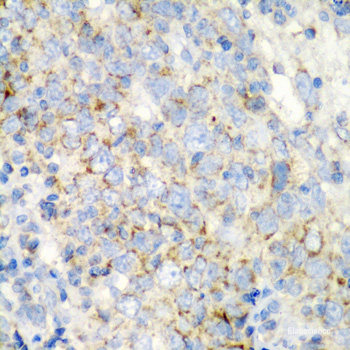 Immunohistochemistry of paraffin-embedded Rat kidney using DAP Polyclonal Antibody at dilution of  1:200 (40x lens).