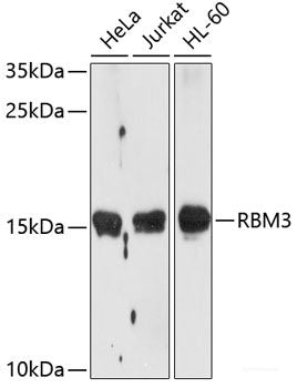 Immunohistochemistry of paraffin-embedded Human stomach using TNFRSF10A Polyclonal Antibody at dilution of  1:100 (40x lens).