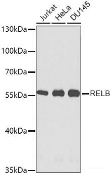 Immunofluorescence analysis of THP-1 cells using CR1 Polyclonal Antibody at dilution of  1:100. Blue: DAPI for nuclear staining.