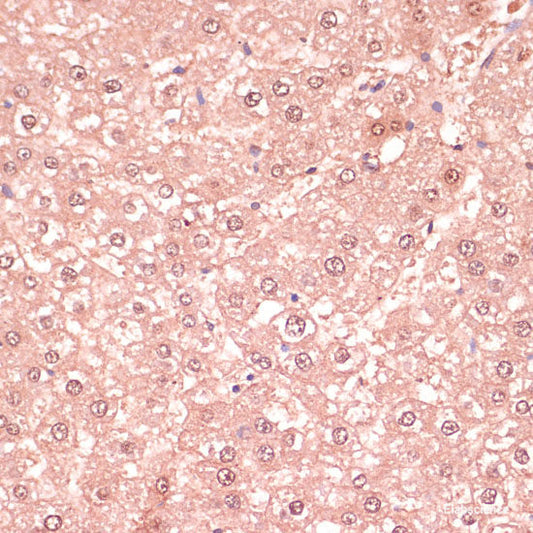 Immunohistochemistry of paraffin-embedded Mouse liver using ULk1 Polyclonal Antibody at dilution of  1:100 (40x lens).
