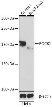 Immunofluorescence analysis of Rat brain using MEGF10 Polyclonal Antibody at dilution of  1:100. Blue: DAPI for nuclear staining.