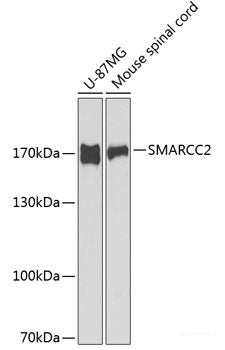Immunohistochemistry of paraffin-embedded Human prostate using Wnt5a Polyclonal Antibody at dilution of  1:100 (40x lens).