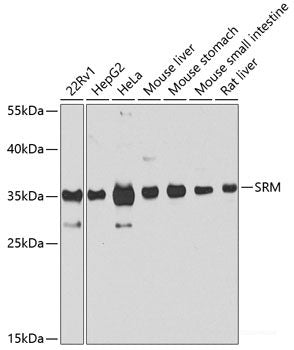 Immunohistochemistry of paraffin-embedded Human stomach using HLA-DMB Polyclonal Antibody at dilution of  1:100 (40x lens).