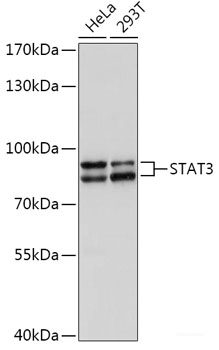 Immunofluorescence analysis of HUVEC cells using VEGF Polyclonal Antibody at dilution of  1:100 (40x lens). Blue: DAPI for nuclear staining.