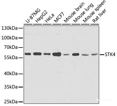 Immunofluorescence analysis of U2OS cells using DHX58 Polyclonal Antibody at dilution of  1:100. Blue: DAPI for nuclear staining.