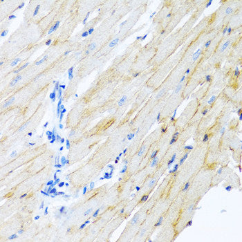 Immunofluorescence analysis of HeLa cells using HOXB9 Polyclonal Antibody at dilution of  1:100 (40x lens). Blue: DAPI for nuclear staining.