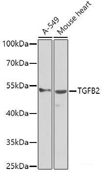 Immunofluorescence analysis of U2OS cells using GOSR1 Polyclonal Antibody at dilution of  1:100. Blue: DAPI for nuclear staining.