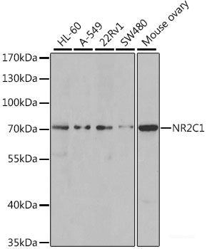Immunohistochemistry of paraffin-embedded Human prostate cancer using ASIP Polyclonal Antibody at dilution of  1:100 (40x lens).