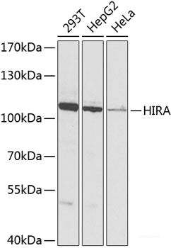 Immunohistochemistry of paraffin-embedded Rat spinal cord using HDGFRP3 Polyclonal Antibody at dilution of  1:100 (40x lens).