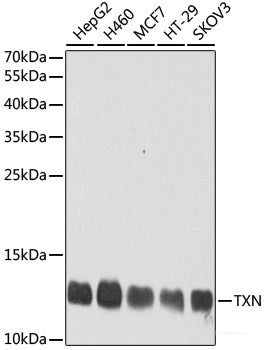 Immunohistochemistry of paraffin-embedded Human liver damage using DARS2 Polyclonal Antibody at dilution of  1:100 (40x lens).