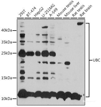 Immunofluorescence analysis of C6 cells using HMGCS1 Polyclonal Antibody at dilution of  1:100 (40x lens). Blue: DAPI for nuclear staining.