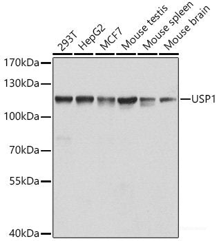 Immunohistochemistry of paraffin-embedded Human colon carcinoma using SS18 Polyclonal Antibody at dilution of  1:200 (40x lens).