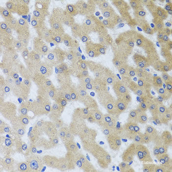 Immunohistochemistry of paraffin-embedded Mouse brain using SS18L1 Polyclonal Antibody at dilution of  1:100 (40x lens).