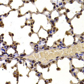 Immunofluorescence analysis of U2OS cells using CDK16 Polyclonal Antibody at dilution of  1:100. Blue: DAPI for nuclear staining.