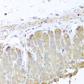 Immunofluorescence analysis of U2OS cells using ABCE1 Polyclonal Antibody at dilution of  1:100. Blue: DAPI for nuclear staining.