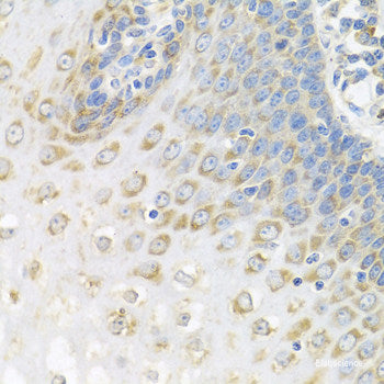 Immunohistochemistry of paraffin-embedded Rat brain using BTD Polyclonal Antibody at dilution of  1:100 (40x lens).
