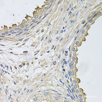 Immunofluorescence analysis of U-2 OS cells using PHLPP1 Polyclonal Antibody at dilution of  1:100 (40x lens). Blue: DAPI for nuclear staining.