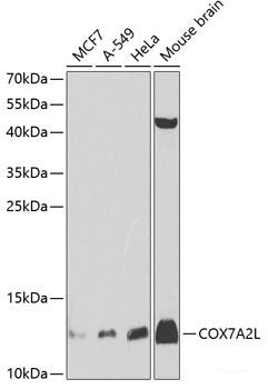 Immunohistochemistry of paraffin-embedded Mouse kidney using SYNPO Polyclonal Antibody at dilution of  1:100 (40x lens).