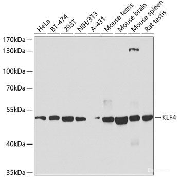 Immunofluorescence analysis of U-2 OS cells using ZBED1 Polyclonal Antibody at dilution of  1:100. Blue: DAPI for nuclear staining.