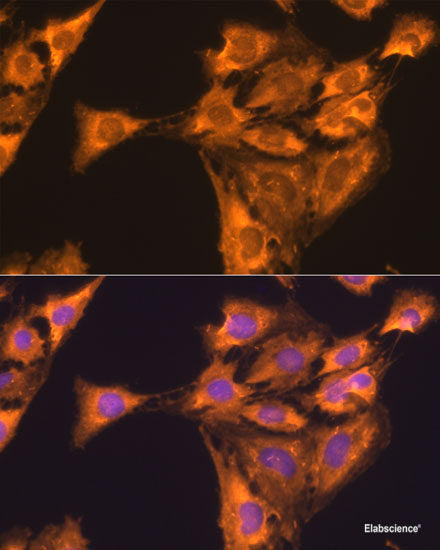 Immunofluorescence analysis of Hela cells using GSTK1 Polyclonal Antibody at dilution of  1:100 (40x lens). Blue: DAPI for nuclear staining.