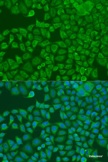 Immunohistochemistry of paraffin-embedded Human breast using Snail Polyclonal Antibody at dilution of  1:100 (40x lens).