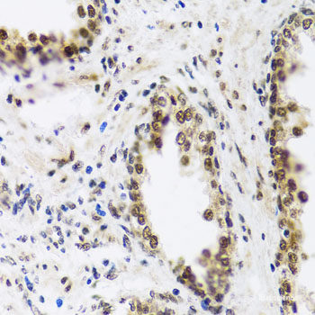 Immunohistochemistry of paraffin-embedded Rat spleen using TLR4 Polyclonal Antibody at dilution of  1:100 (40x lens).