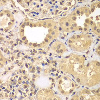 Immunohistochemistry of paraffin-embedded Rat lung using LLGL2 Polyclonal Antibody at dilution of  1:200 (40x lens).