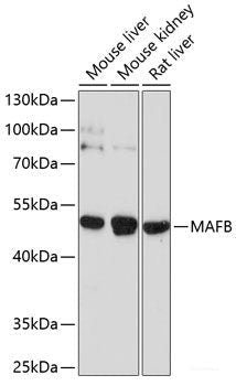 Western blot analysis of extracts of various cell lines using GABBR1 Polyclonal Antibody at dilution of 1:1000.