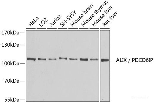 Immunohistochemistry of paraffin-embedded Human colon using RANKL Polyclonal Antibody at dilution of  1:100 (40x lens).