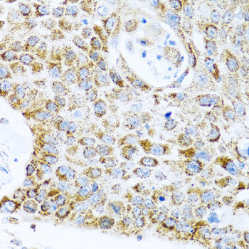 Immunohistochemistry of paraffin-embedded Human esophagus using STAU1 Polyclonal Antibody at dilution of  1:100 (40x lens).