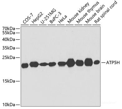 Immunohistochemistry of paraffin-embedded Rat spleen using AIMP1 Polyclonal Antibody at dilution of  1:100 (40x lens).
