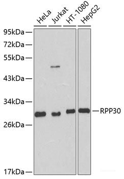 Immunofluorescence analysis of C6 cells using PASK Polyclonal Antibody at dilution of  1:100. Blue: DAPI for nuclear staining.
