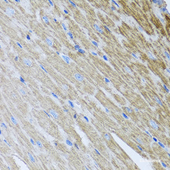Immunohistochemistry of paraffin-embedded Human liver using UCHL3 Polyclonal Antibody at dilution of  1:100 (40x lens).