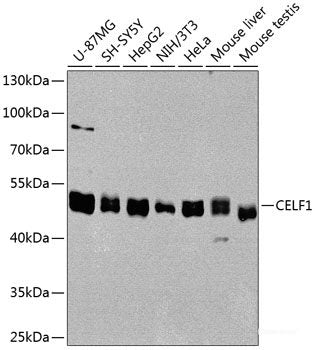 Immunohistochemistry of paraffin-embedded Rat heart using SCARB2 Polyclonal Antibody at dilution of  1:100 (20x lens).