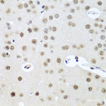 Immunofluorescence analysis of HeLa cells using DLAT Polyclonal Antibody 
