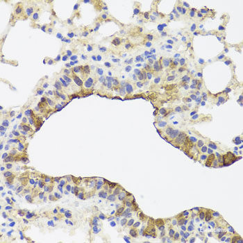 Immunohistochemistry of paraffin-embedded Rat lung using GTF2H2 Polyclonal Antibody at dilution of  1:100 (40x lens).