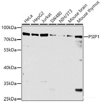 Immunofluorescence analysis of HeLa cells using ZFYVE9 Polyclonal Antibody at dilution of  1:100. Blue: DAPI for nuclear staining.