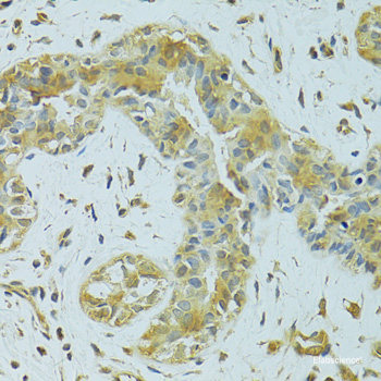 Immunofluorescence analysis of U2OS cells using HYLS1 Polyclonal Antibody at dilution of  1:100. Blue: DAPI for nuclear staining.