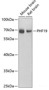 Immunohistochemistry of paraffin-embedded Human esophagus using STXBP4 Polyclonal Antibody at dilution of  1:100 (40x lens).