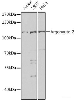 Immunohistochemistry of paraffin-embedded Mouse brain using VSNL1 Polyclonal Antibody at dilution of  1:200 (40x lens).