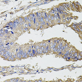 Immunohistochemistry of paraffin-embedded Human colon using AZGP1 Polyclonal Antibody at dilution of  1:100 (40x lens).