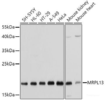 Immunohistochemistry of paraffin-embedded Rat liver using OXA1L Polyclonal Antibody at dilution of  1:100 (40x lens).