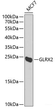 Immunohistochemistry of paraffin-embedded Human colon carcinoma using SURF1 Polyclonal Antibody at dilution of  1:100 (40x lens).