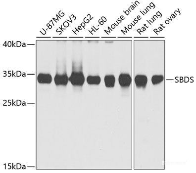 Immunohistochemistry of paraffin-embedded Rat brain using IL22 Polyclonal Antibody at dilution of  1:100 (40x lens).
