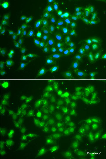 Immunofluorescence analysis of U2OS cells using IL27RA Polyclonal Antibody at dilution of  1:100. Blue: DAPI for nuclear staining.