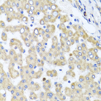 Immunohistochemistry of paraffin-embedded Mouse brain using GNE Polyclonal Antibody at dilution of  1:100 (40x lens).