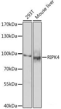 Immunofluorescence analysis of HeLa cells using EPB41L2 Polyclonal Antibody at dilution of  1:100. Blue: DAPI for nuclear staining.