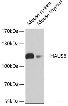 Western blot analysis of extracts of Mouse liver using SCP2 Polyclonal Antibody at dilution of 1:1000.