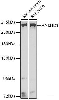 Immunohistochemistry of paraffin-embedded Mouse lung using MARK1 Polyclonal Antibody at dilution of  1:100 (40x lens).